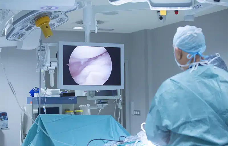 Arthroscopic Surgery Img